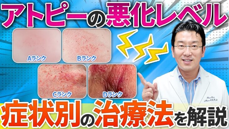【初心者向け】自分のアトピー肌レベルに合ったスキンケアの選び方と注意点